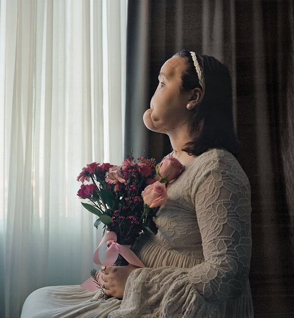 Katie Stubblefield antes del transplante. (Maggie Steber/National Geographic)