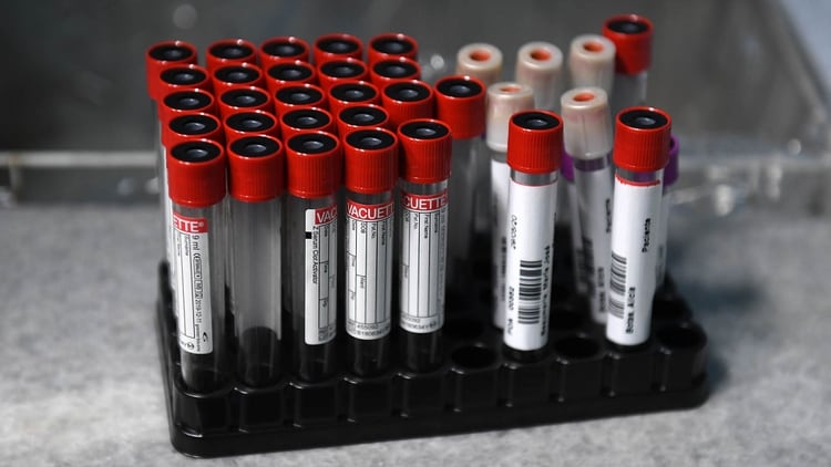 El equipo de hemoterapia del Hospital de Clínicas pasó de 25 pedidos de sangre por día a 10 desde que se desató la pandemia (Maximiliano Luna)