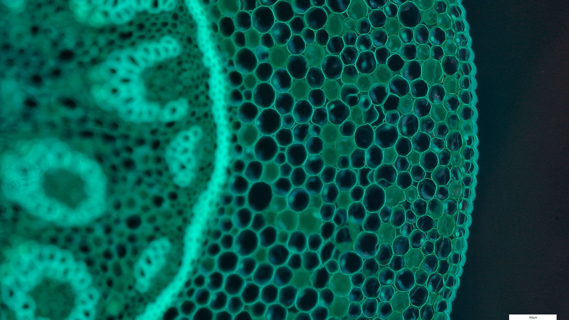 El virus de la hepatitis C actúa de forma silenciosa y no hay manifestación de la enfermedad por muchos años (Gettyimages)