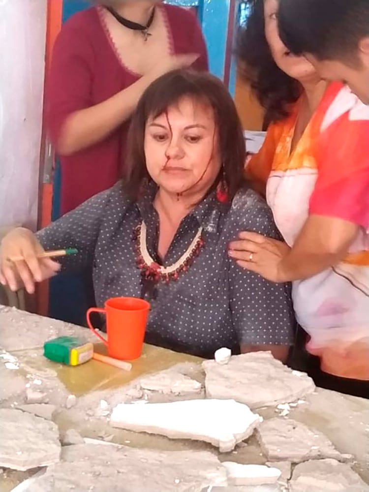 La mujer sufrió varios golpes y cortes en la cabeza, hombros y brazos (Facebook: Tribuna Docente Fcio. Varela)