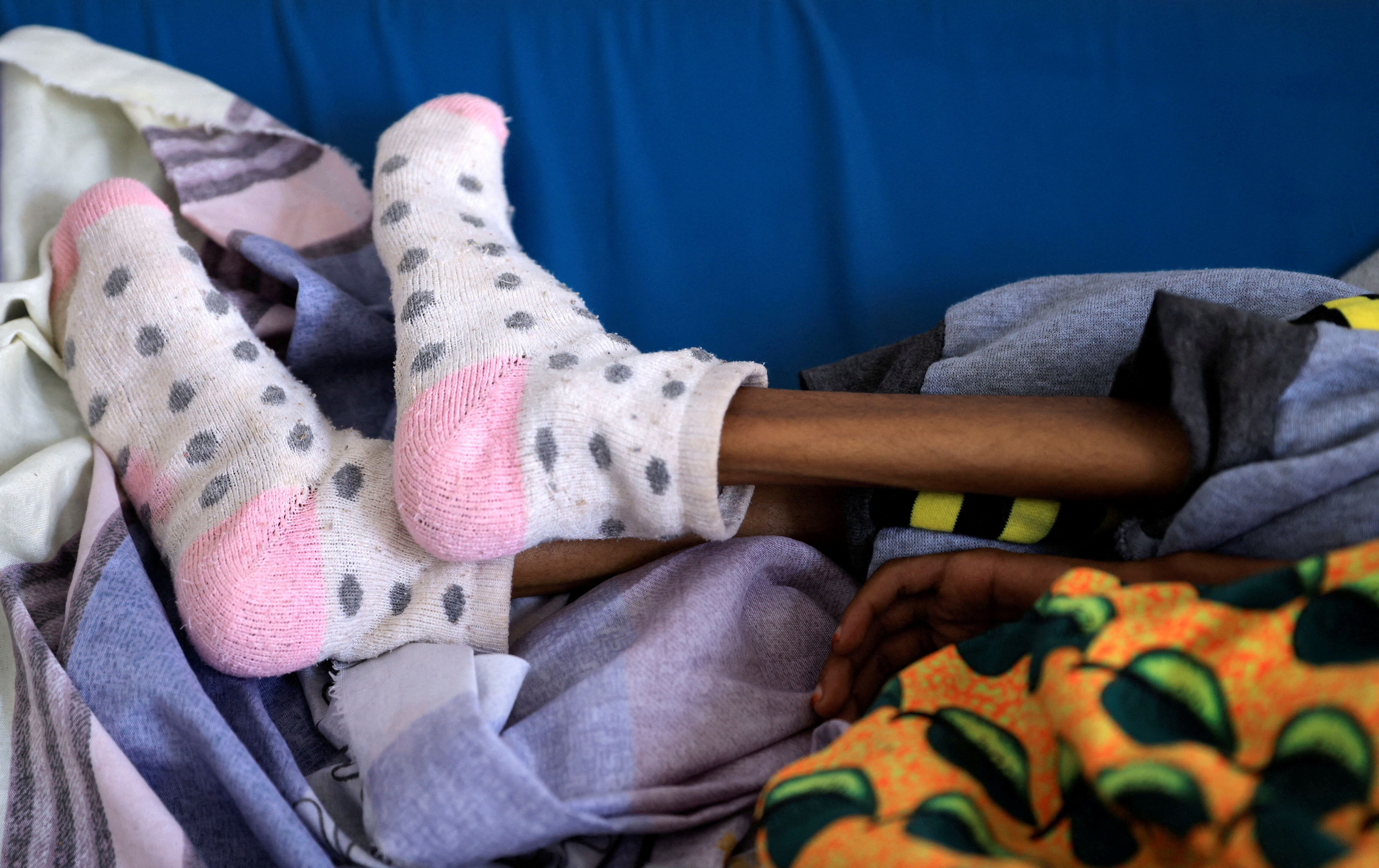 Tsige Shishay, de 10 años, una niña gravemente desnutrida que pesa 10 kg debido a la suspensión de la ayuda alimentaria del Programa Mundial de Alimentos (PMA) de las Naciones Unidas y de la Agencia de Estados Unidos para el Desarrollo Internacional (USAID), yace en su cama en el Hospital de Referencia Ayder, en Mekele. REUTERS/Tiksa Negeri