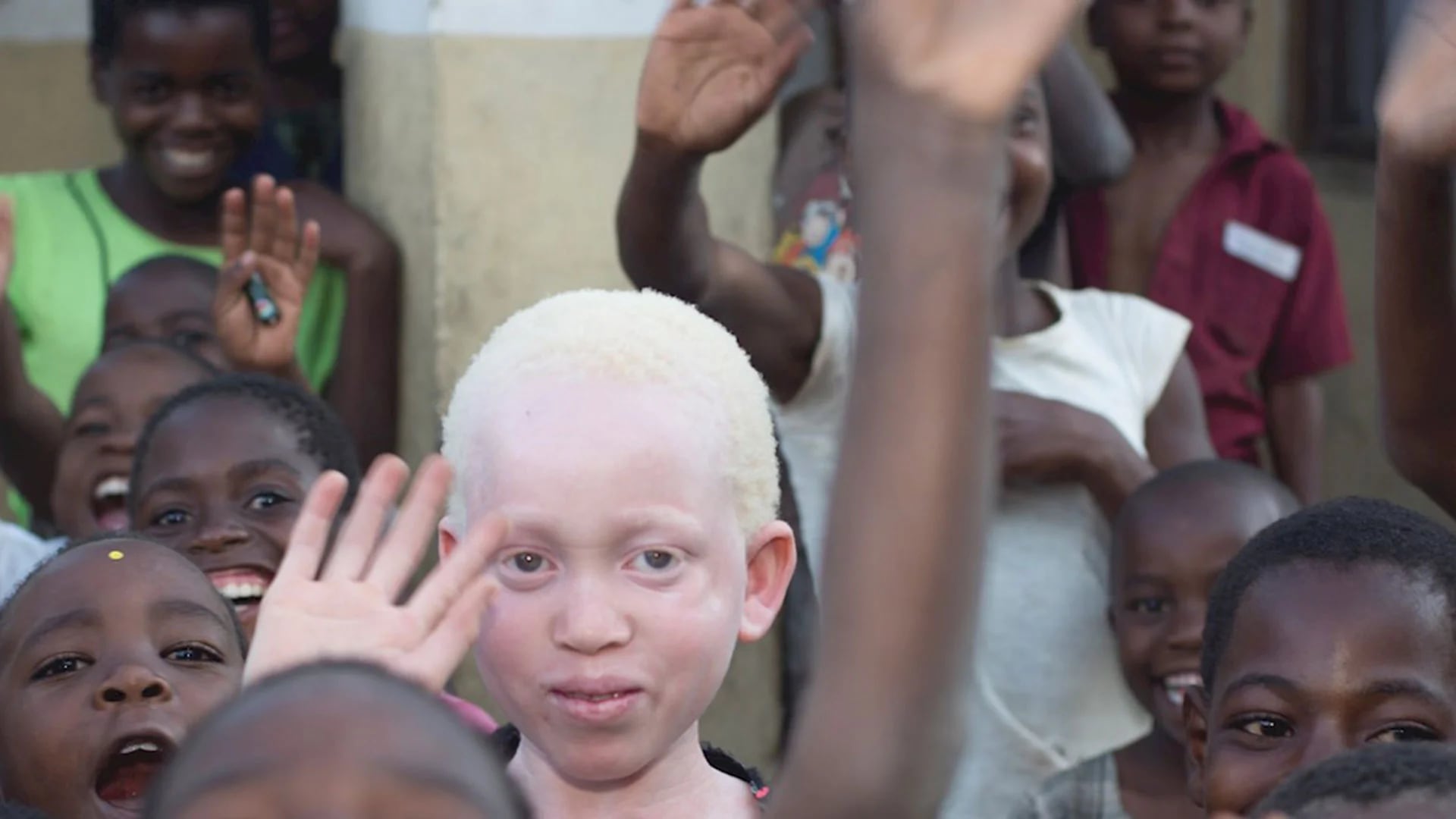 En abril se registraron cuatro asesinatos de albinos en Malawi. El Gobierno, sin reacción (Amnesty International)