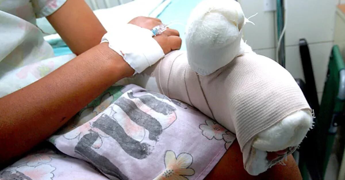 Justice grants protective measures to a minor who was burned by her mother in Huancayo
