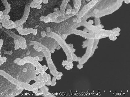 Una imagen de microscopía de una de las células infectadas por el virus SARS-CoV-2 y las protuberancias que utiliza para inyectar su veneno en células aún sanas (UC San Francisco)