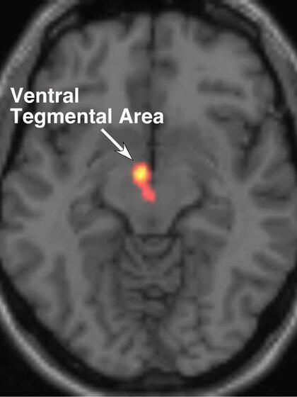 El área tegmental ventral genera dopamina y la manda a distintas regiones del cerebro