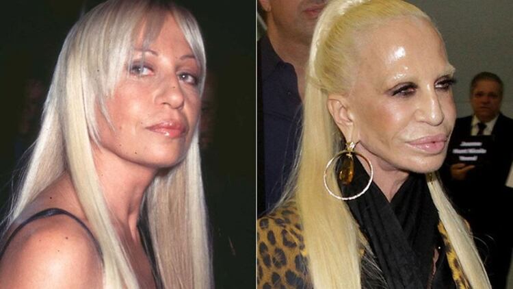 En un par de décadas, Donatella modificó su rostro de manera increíble