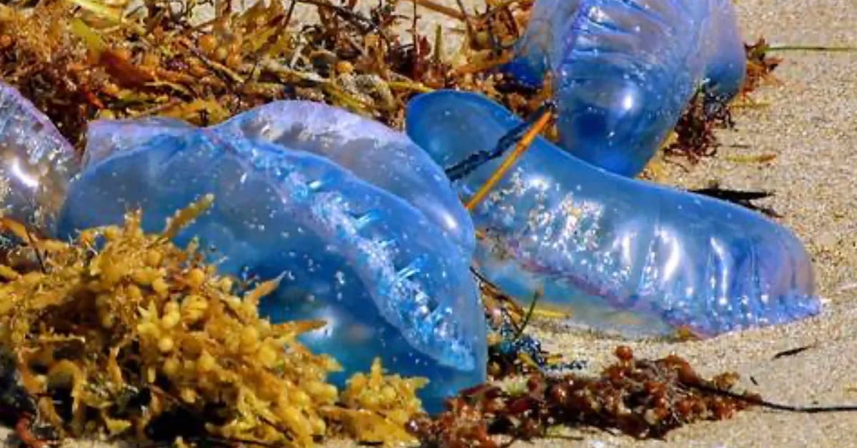 Jellyfish hit South Florida beaches