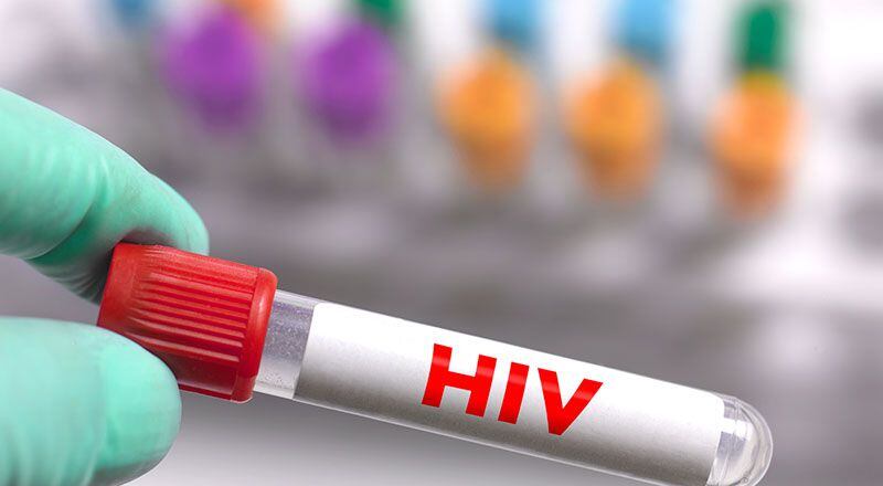 Hoy existen tratamientos para cronificar la enfermedad del SIDA (NIH)