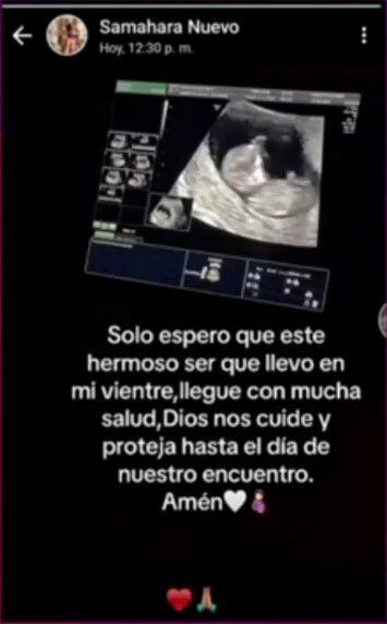 Samahara Lobatón anuncia embarazo y comparte ecografía. (Captura: Magaly TV La Firme)