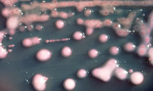  La bacteria Klebsiella pneumoniae puede afectar a pacientes internados   y puede resistir a los antibióticos de amplio espectro/Archivo