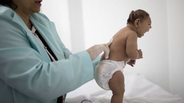 El zika puede llevar a un defecto de nacimiento llamado microcefalia (AP)