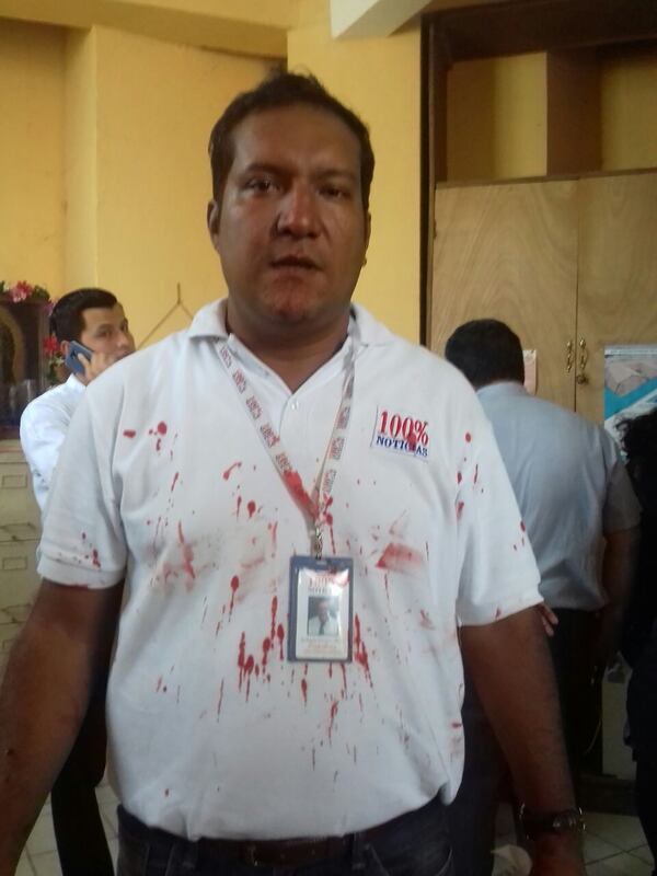 Los periodistas también son víctimas de la violencia del régimen en Nicaragua