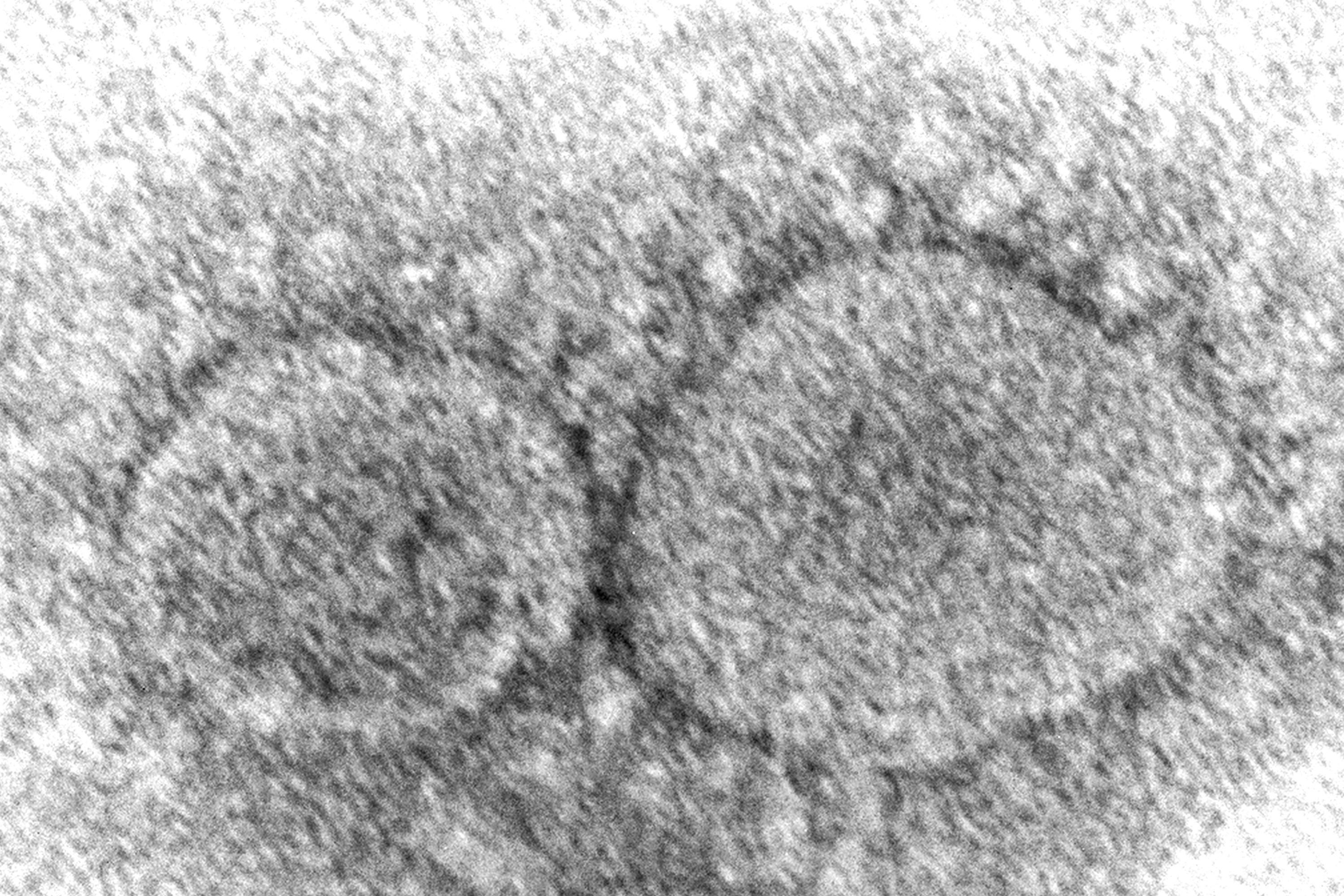 Esta imagen de microscopio de 2020 proporcionada por los Centros para el Control y la Prevención de Enfermedades de Estados Unidos muestra partículas del virus SARS-CoV-2, que causan el COVID-19 (Hannah A. Bullock, Azaibi Tamin/CDC via AP, Archivo)