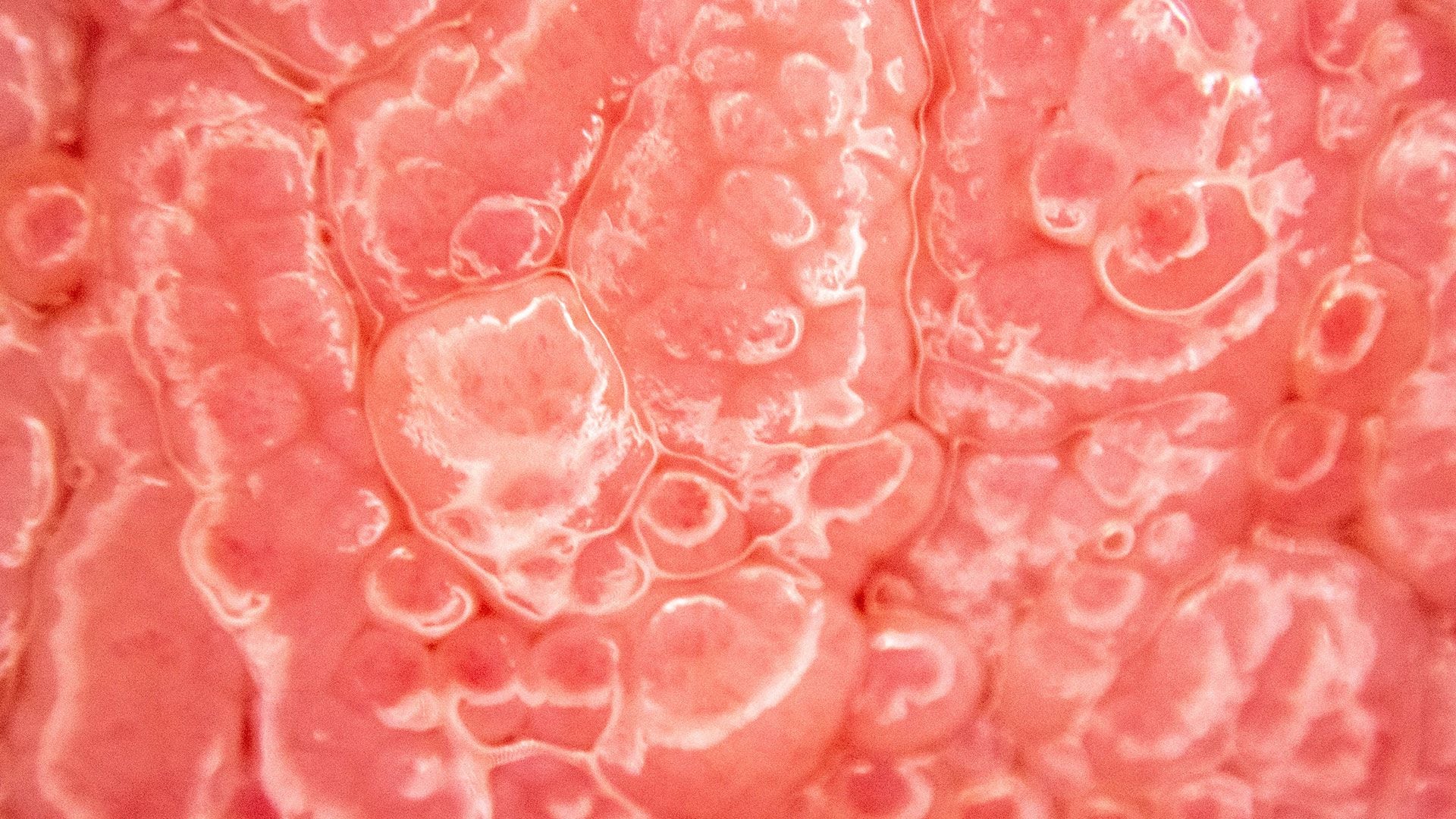 La lengua bajo el microscopio (Gettyimages)