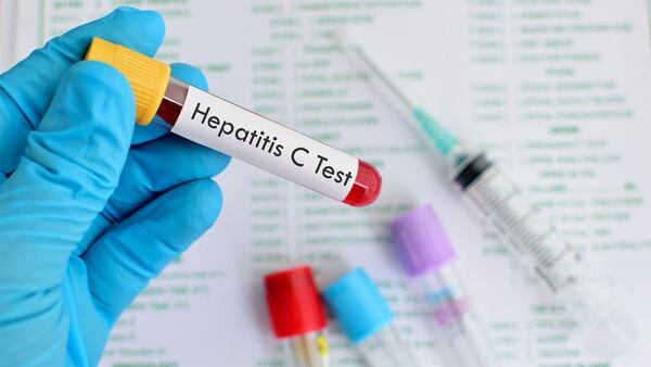 Es cada vez más frecuente encontrar personas que han adquirido la hepatitis C debido a la reutilización o la esterilización inadecuada, especialmente de jeringas y agujas o a través de transfusiones de sangre y productos sanguíneos sin analizar (Getty Images)
