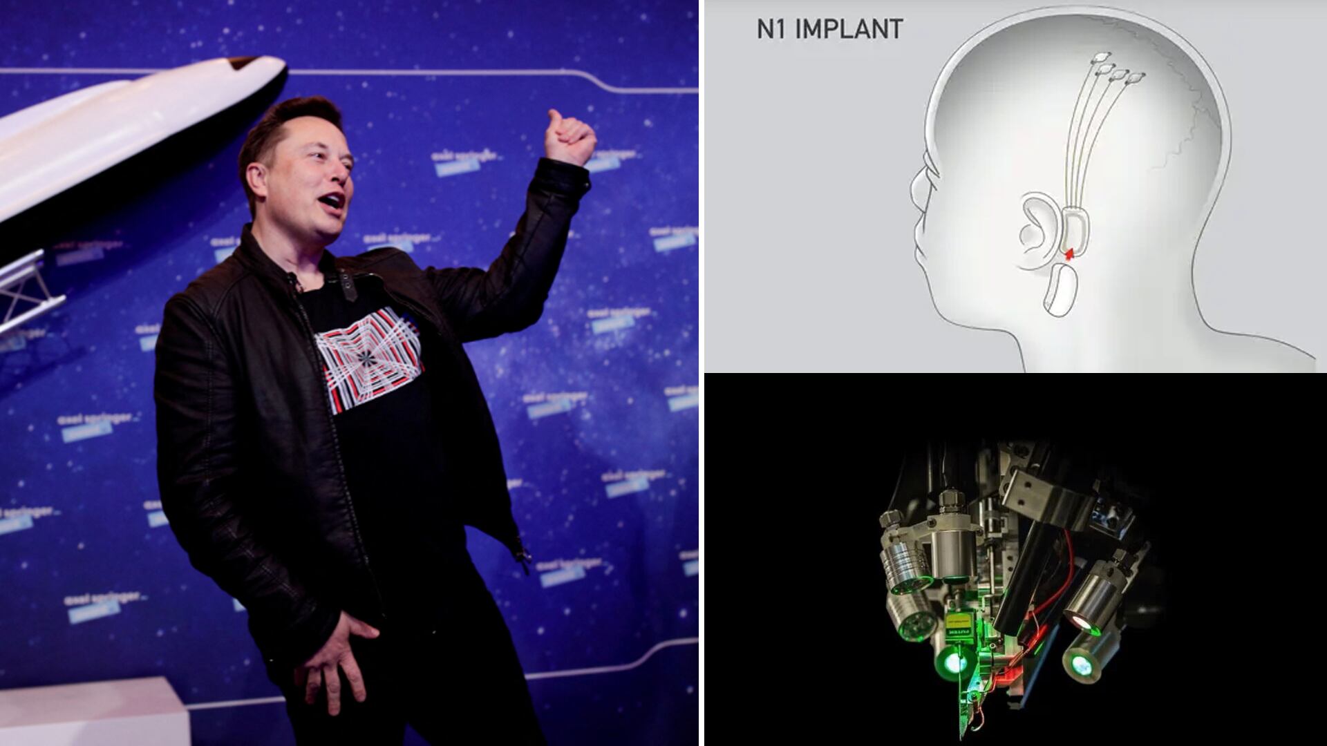 La empresa de Elon Musk, Neuralink, tiene a miles de interesados en recibir su chip dentro de sus cabezas, mediante una cirugía cerebral.