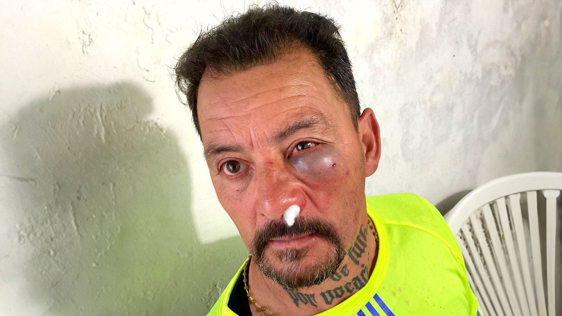 Brutal agresión de un jugador a un árbitro de fútbol en Uruguay: “Me pegó por atrás y de cobarde”