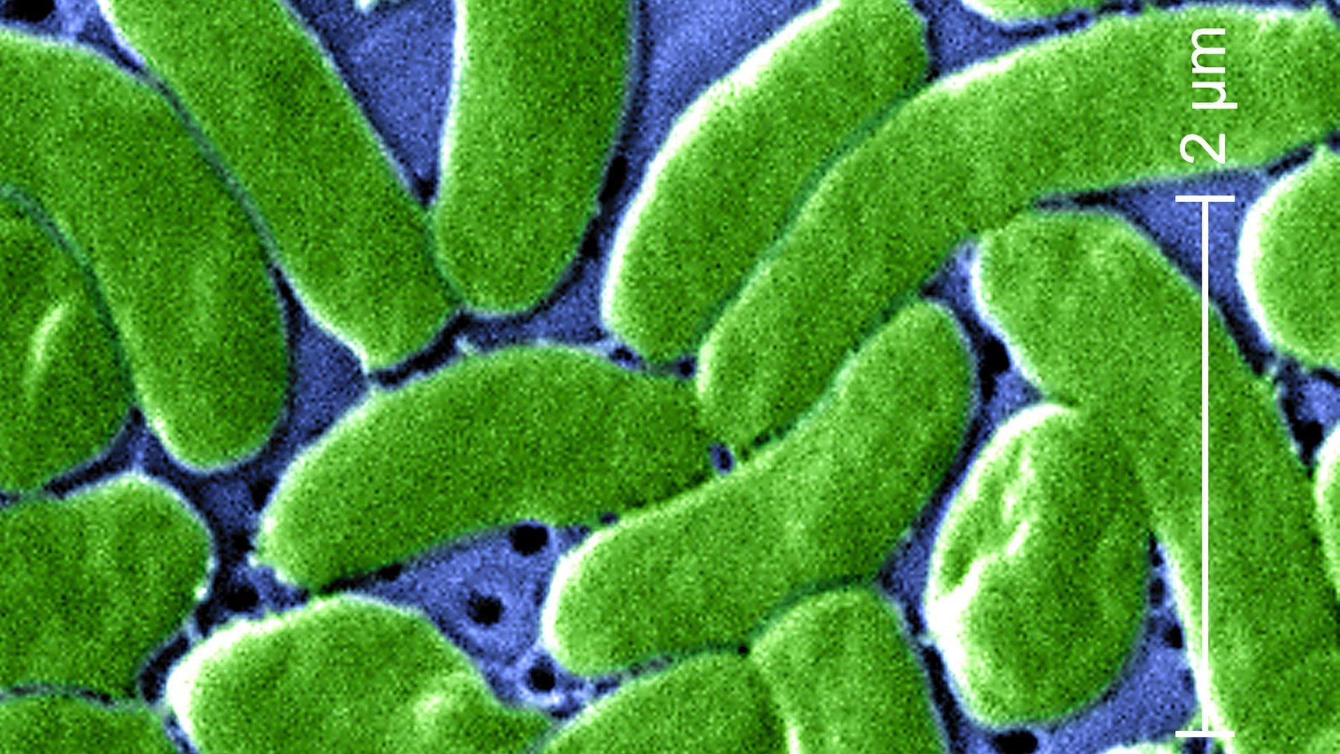 La bacteria Vibrio vulnificus es causante de una infección potencialmente mortal