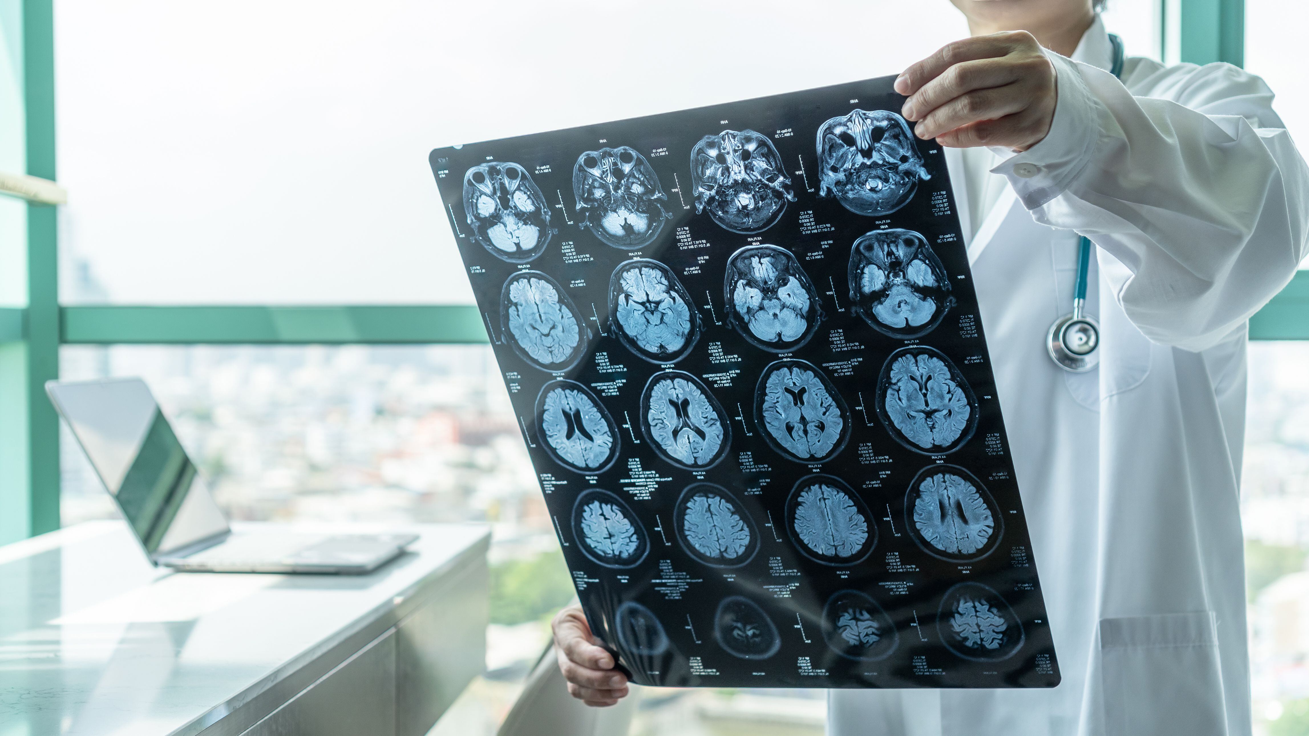 Diagnóstico de enfermedad cerebral (Shutterstock)