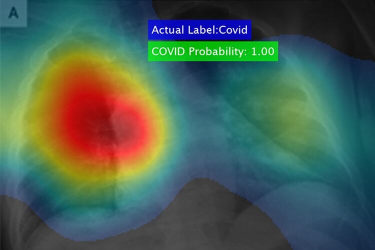 La Universidad de Dayton difundió una imagen del software capaz de detectar el coronavirus