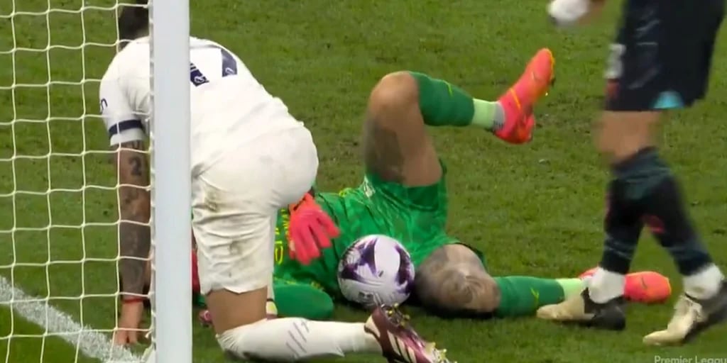 La increíble lesión facial que sufrió una figura del rugby en pleno partido: “Todos mis compañeros se reían”