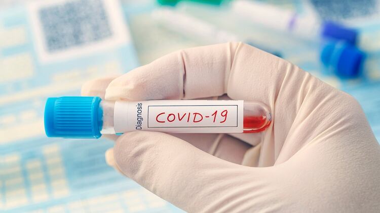 El expertos calculan que la vacuna contra el COVID-19 estará para fines de diciembre o los primeros meses de 2021 (Shutterstock)