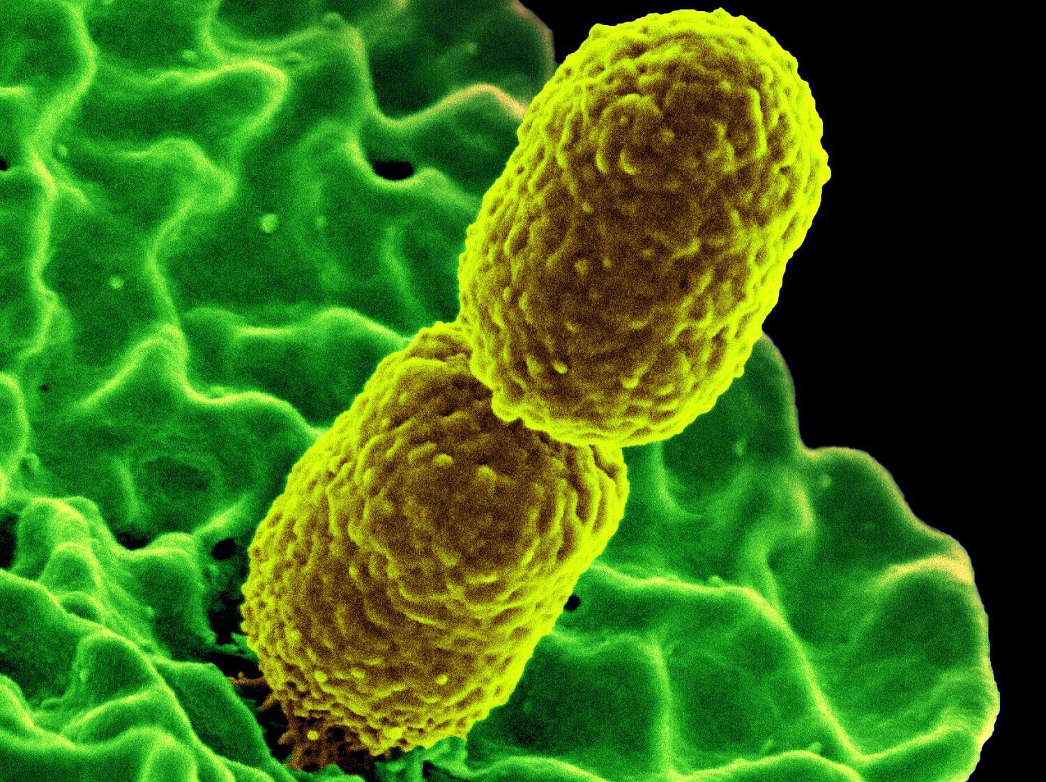 The intestinal inhabitant Klebsiella pneumoniae is one of the most dreaded hospital germs. © NIAIDCREDITNational Institute of Allergy and Infectious Diseases (NIAID)