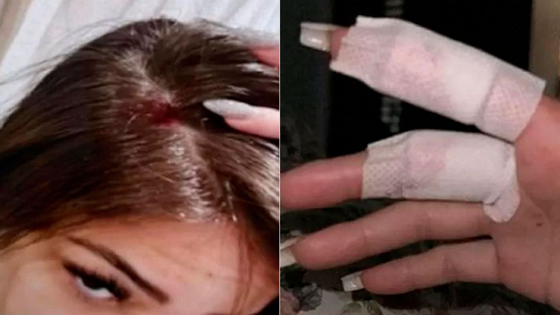 Las lesiones en la cabeza y mano que la influencer sufrió por el maltrato del futbolista (Foto: UOL)