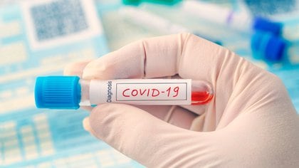 Estudios iniciales de pacientes con COVID-19 recuperados han revelado una variabilidad significativa en sus respuestas de anticuerpos al virus (Shutterstock)