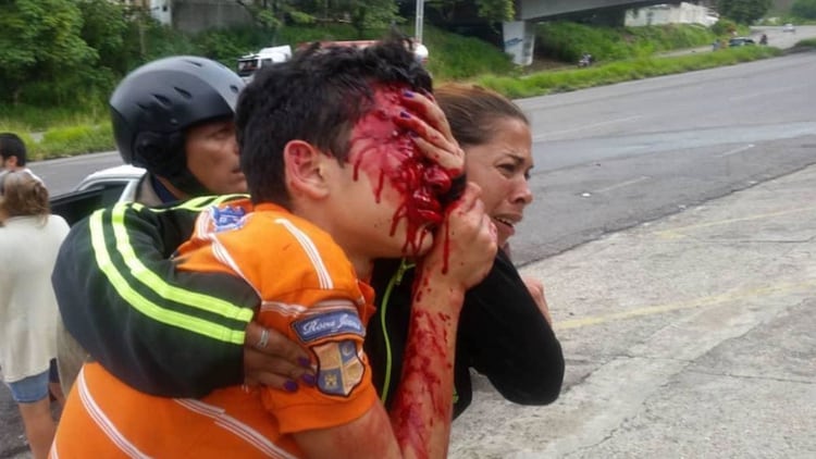 Rufo Chacón perdió los ojos a causa de la represión chavista