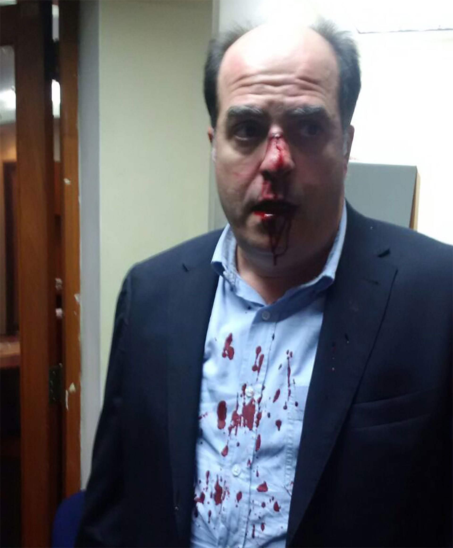 El diputado opositor Julio Borges en 2016, luego de ser golpeado al concurrir a la justicia electoral de Venezuela para pedir explicaciones sobre el referéndum revocatorio que en ese entonces promovía Maduro (@hcapriles)