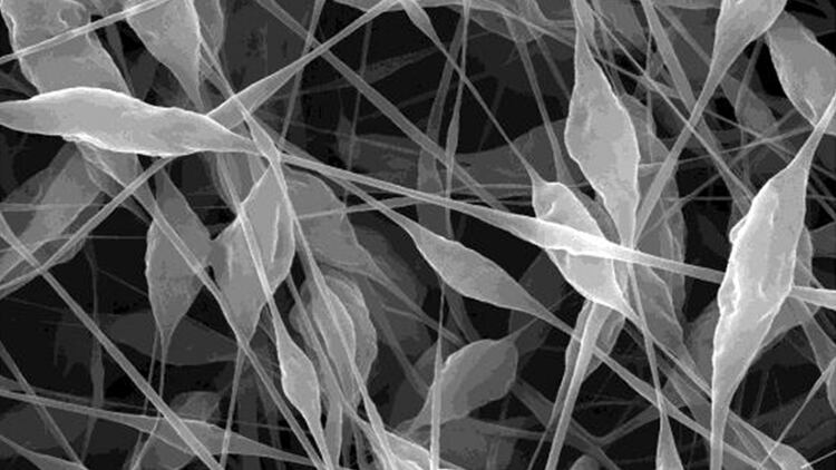 Las nanopartículas tienen una escala que solo puede ser apreciada mediante microscopios especiales. Foto: Archivo DEF.