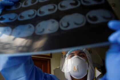 Los síntomas respiratorios siguen siendo las manifestaciones más comunes de COVID-19 en pacientes que van al hospital (REUTERS/Santiago Arcos)