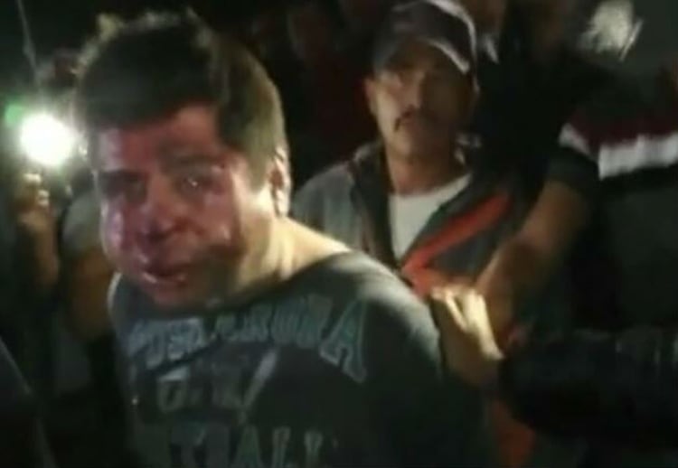 AsÃ­ terminÃ³ el hombre golpeado por habitantes de San MartÃ­n Texmelucan (Foto: Twitter pulsoregional)