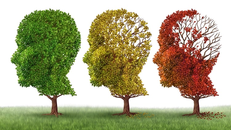 El Alzheimer, la primera causa de demencia en el mundo, afecta a casi 50 millones de personas, y podría llegar a 131 millones en 2050. (Shutterstock)