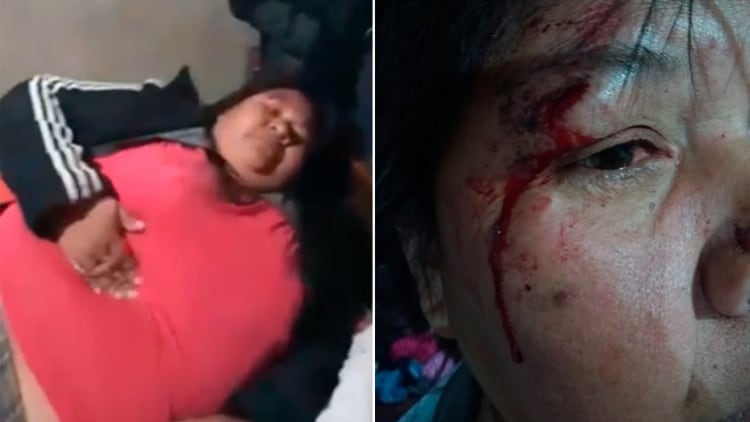 Imagen de víctimas del ataque policial a integrantes de la comunidad Qom en Chaco. 