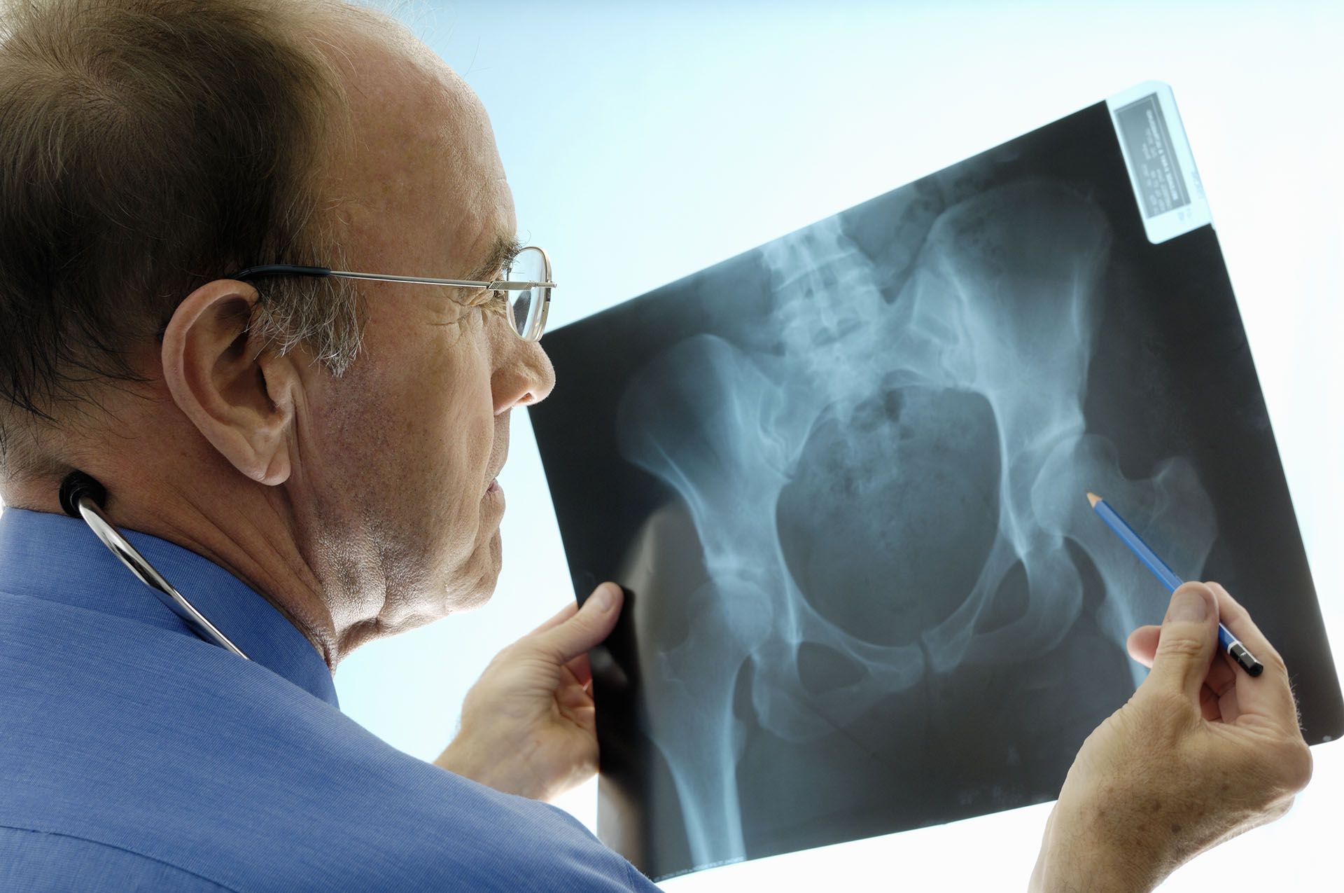 Las etapas iniciales de la disminución de la masa ósea no presentan síntomas
(Getty Images)