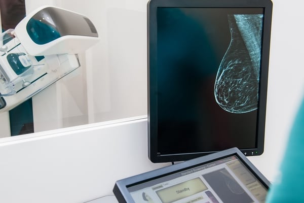 Uno de los estudios es la mamografía. Se prefiere la digital con tomosíntesis por una cuestión de mejor calidad diagnóstica, pero no en todos los lugares tienen acceso, entonces se recomienda la mamografía y una ecografía mamaria (Getty Images)