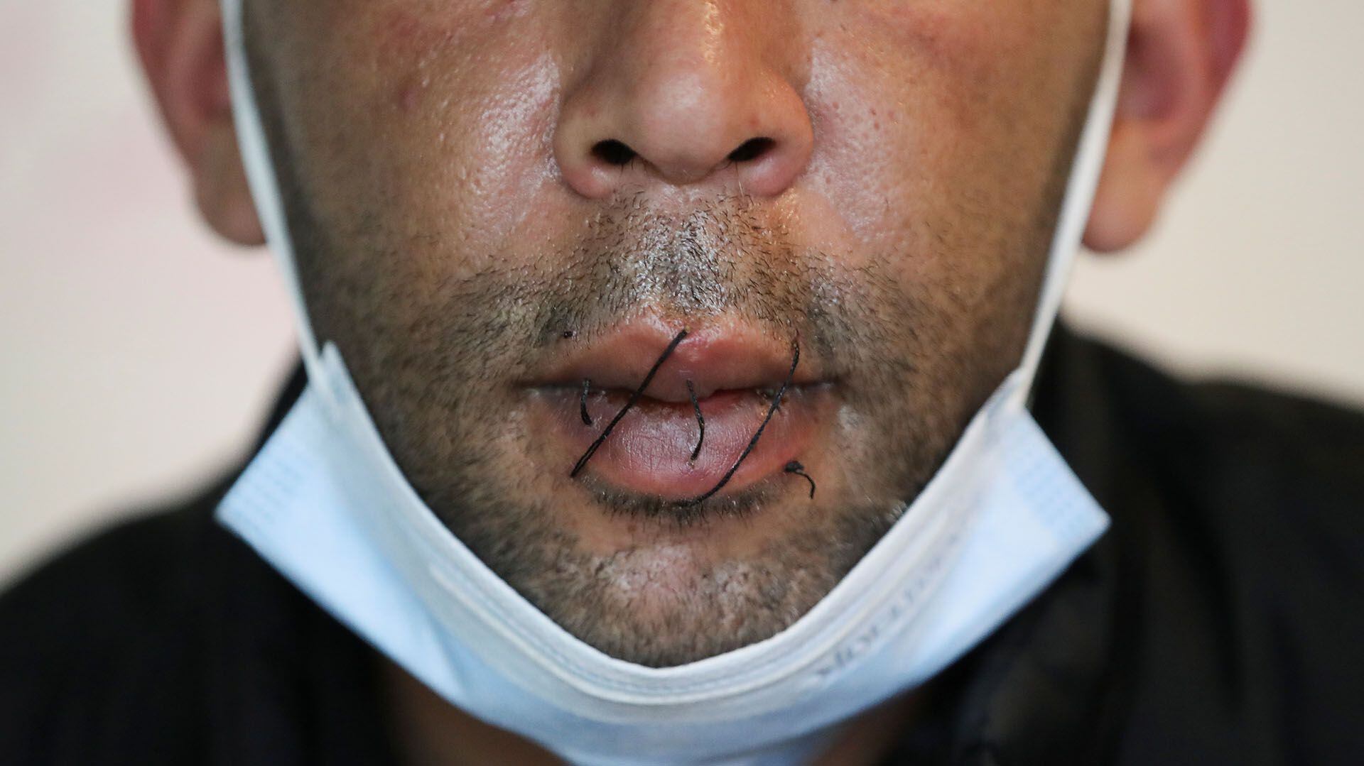 Algunos solicitantes de asilo se cocieron la boca (Foto: REUTERS)