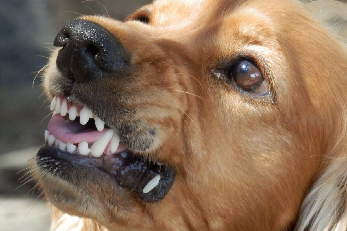 Las mordeduras de los perros pueden tener graves consecuencias. (Foto: Pixabay)