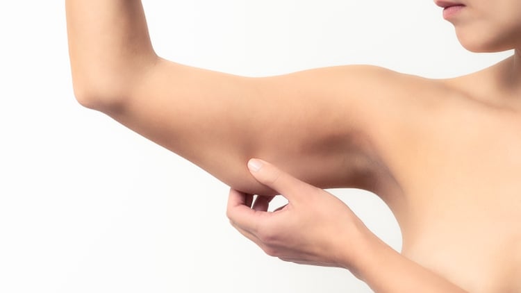 La flacidez está causada por la disminución de la elastina que le da elasticidad, y del colágeno que es el que aporta resistencia a la piel (Shutterstock)