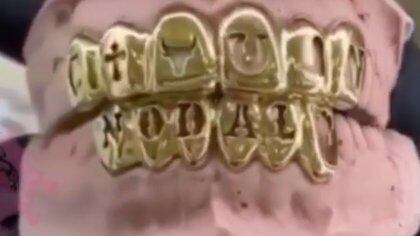 La imagen de los dientes de oro