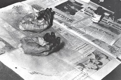Las manos seccionadas del Che Guevara para facilitar su identificación, donde los dedos llenos de tinta para tomar sus huellas digitales