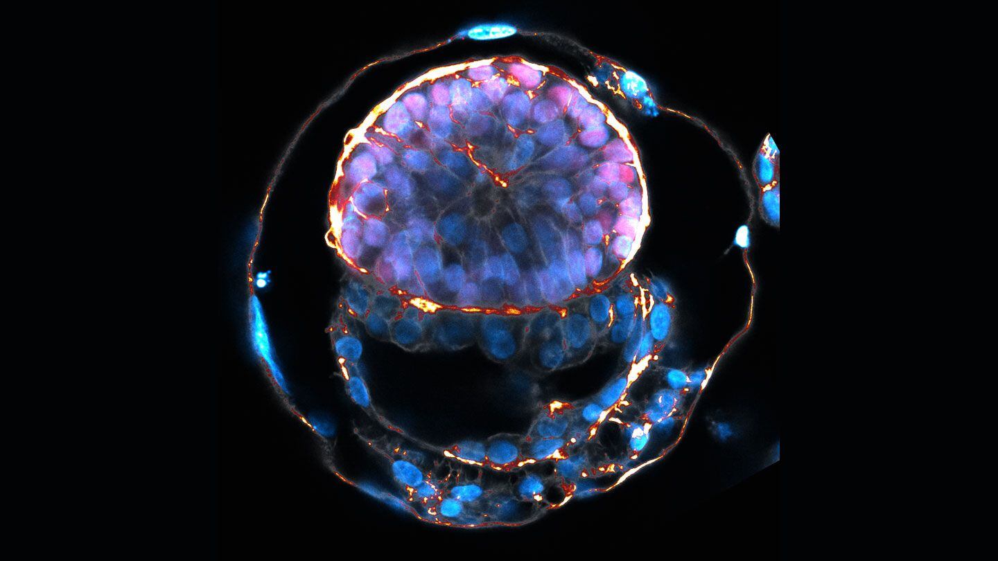 Este avance científico sin precedentes se basa en la creación de embriones sintéticos desde células madre
Gentileza: Jacob Hanna/Instituto Weizmann de Ciencias