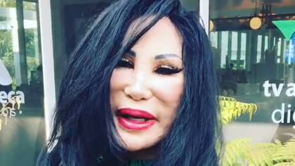 Por un mal tratamiento estético el rostro de Lyn May se deformó (IG: lyn_may_)