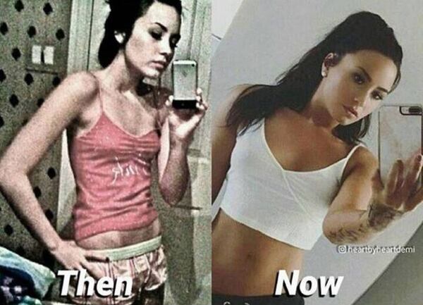 El antes y después de Demi Lovato