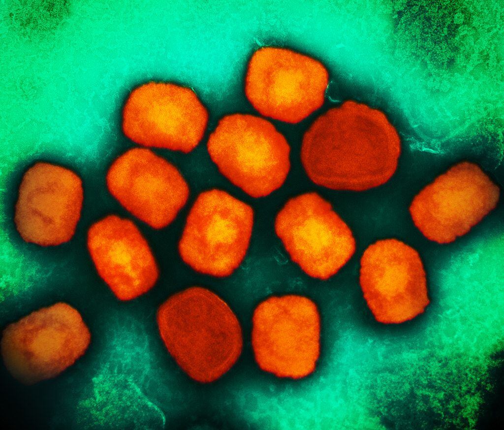 Colorized transmission electron micrograph of monkeypox virus particles (orange) cultivated and purified from cell culture. Image captured at the NIAID Integrated Research Facility (IRF) in Fort Detrick, Maryland.  CREDIT NIAID