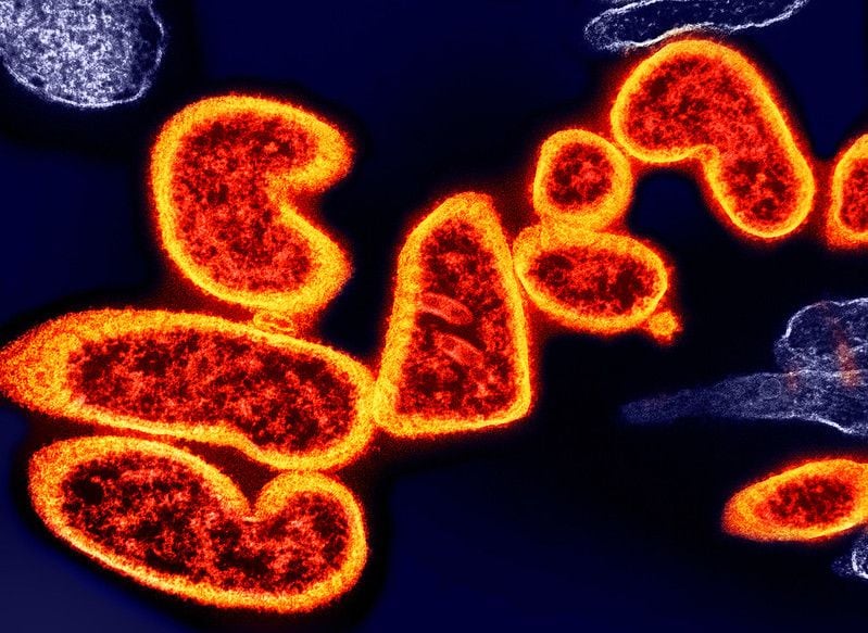 El riesgo de que el virus Nipah llegue a transmitirse en Iberoamérica hoy es bajo. Pero no es igual a cero (NIAID)