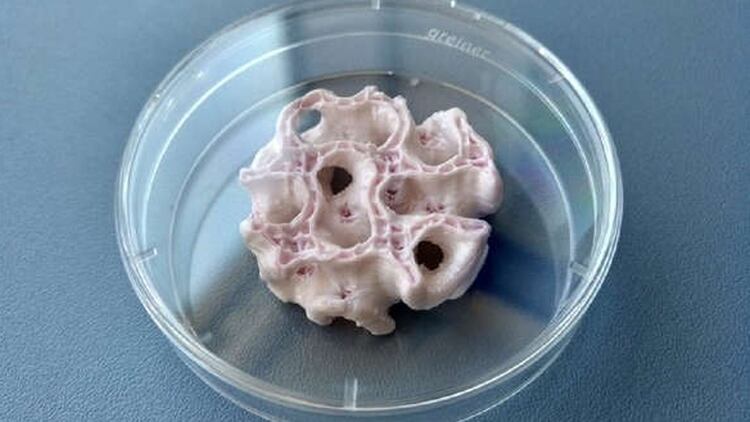 El material bioimpreso procedería del propio astronauta, por lo que no habría problemas de rechazo en el organismo | Fuente: ESA