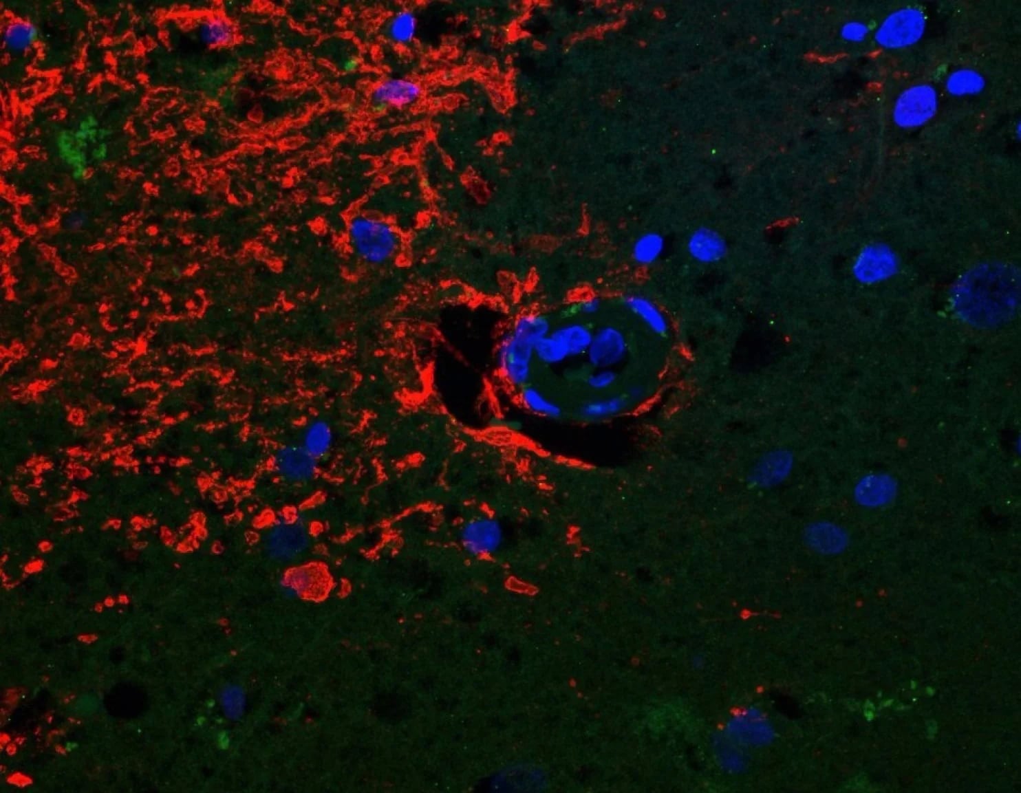 Una imagen del cerebro de una persona mayor que sufre del mal de Alzheimer. En rojo se ve una proteína que en las personas sanas se presenta de manera ordenada. (Oregon Health and Science University).